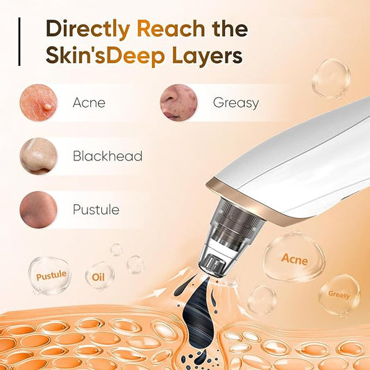 Electric Blackhead & Pore Vacuum Cleaner – Face & Nose