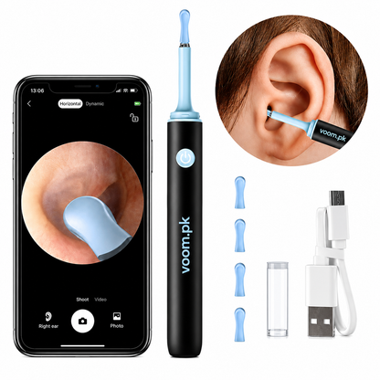 Rechargeable Ear Camera – Smart Wireless Visual Ear Wax Removal Tool Kit
