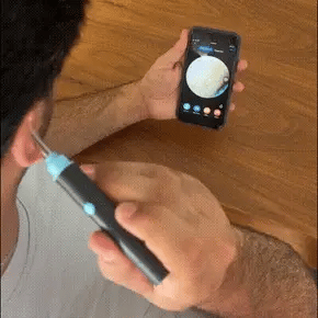 Rechargeable Ear Camera – Smart Wireless Visual Ear Wax Removal Tool Kit